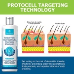 Roycederm Psoriasis Shampoo, Seborrheic Dermatitis Shampoo, Folliculitis Shampoo, Dandruff Shampoo, Scalp Psoriasis Treatment, Seborrheic Dermatitis Treatment, Dry Itchy Scalp Treatment, Dandruff Treatment. - Image 6
