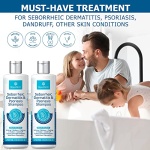 Roycederm Psoriasis Shampoo, Seborrheic Dermatitis Shampoo, Folliculitis Shampoo, Dandruff Shampoo, Scalp Psoriasis Treatment, Seborrheic Dermatitis Treatment, Dry Itchy Scalp Treatment, Dandruff Treatment. - Image 4
