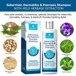 Roycederm Psoriasis Shampoo, Seborrheic Dermatitis Shampoo, Folliculitis Shampoo, Dandruff Shampoo, Scalp Psoriasis Treatment, Seborrheic Dermatitis Treatment, Dry Itchy Scalp Treatment, Dandruff Treatment. - Image 7