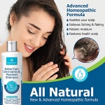 Roycederm Psoriasis Shampoo, Seborrheic Dermatitis Shampoo, Folliculitis Shampoo, Dandruff Shampoo, Scalp Psoriasis Treatment, Seborrheic Dermatitis Treatment, Dry Itchy Scalp Treatment, Dandruff Treatment. - Image 8